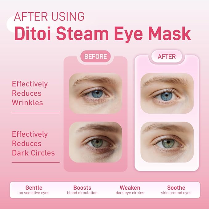 Ditoi Steam Eye Mask, Heated Eye Mask for Sleep,Warm Compress with Hyaluronic Acid,Moist Heat for Dry Eye Relief,Spa,Stye Eye Treatment,Travel Essentials & Relaxation Gifts,Rose 20 Packs