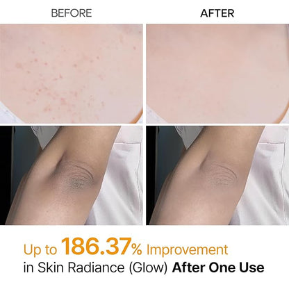 Dr.Melaxin Body Keratin Care Kojic Acid Turmeric Spray Gently Exfoliating Peeling Solution Korean Skincare All Skin Types 200ml