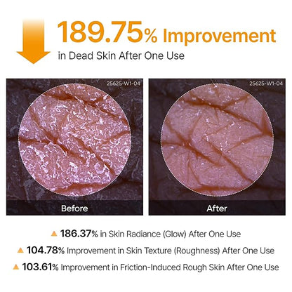 Dr.Melaxin Body Keratin Care Kojic Acid Turmeric Spray Gently Exfoliating Peeling Solution Korean Skincare All Skin Types 200ml