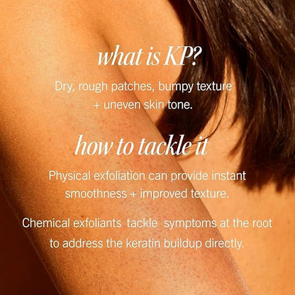 First Aid Beauty KP Bump Eraser Body Scrub with 10% AHA, Keratosis Pilaris Skin Exfoliator with Glycolic and Lactic acids, Helps Reduce Chicken Bumps, Safe for Sensitive Skin, 8 oz